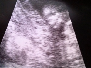 Baby Phillips, 12 weeks